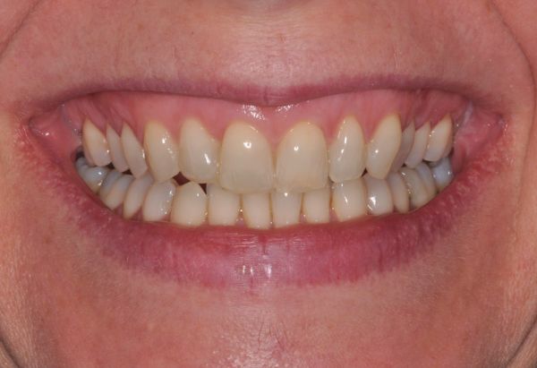 After -Peacock Dental Spa