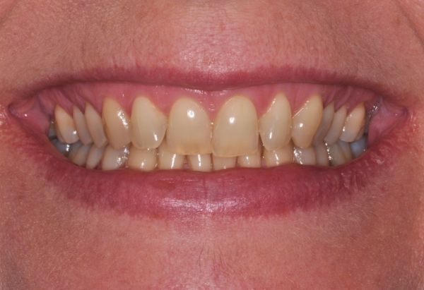 Before - Peacock Dental Spa