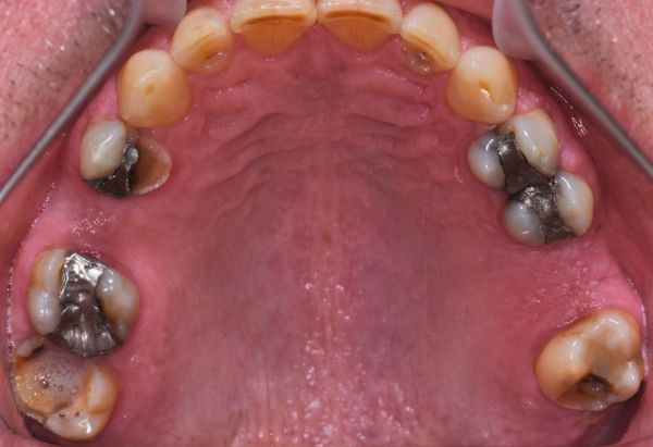 Before - Peacock Dental Spa