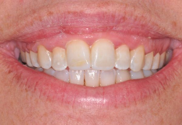 After -Peacock Dental Spa