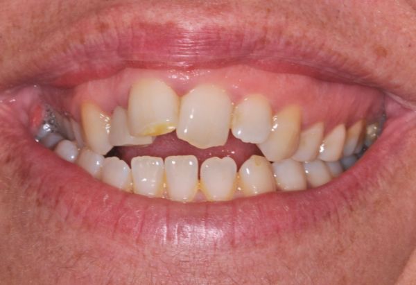 Before - Peacock Dental Spa