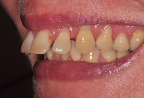 Before - Peacock Dental Spa