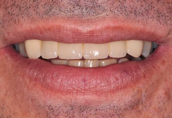 After -Peacock Dental Spa