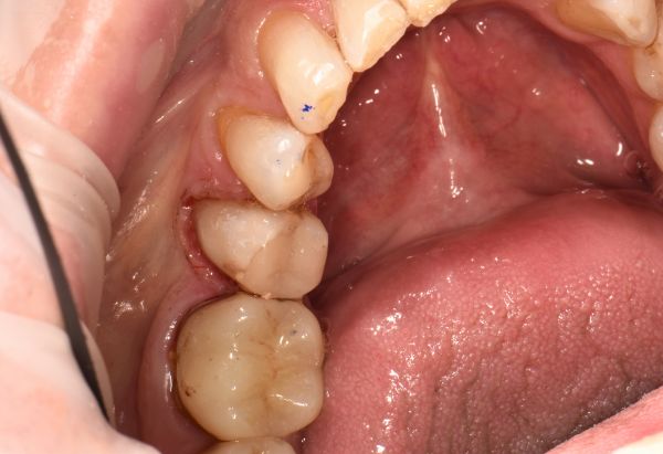 After -Peacock Dental Spa