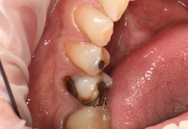 Before - Peacock Dental Spa