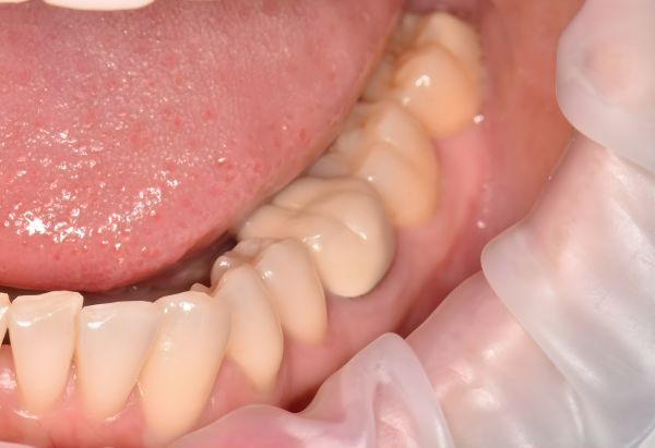 Before - Peacock Dental Spa