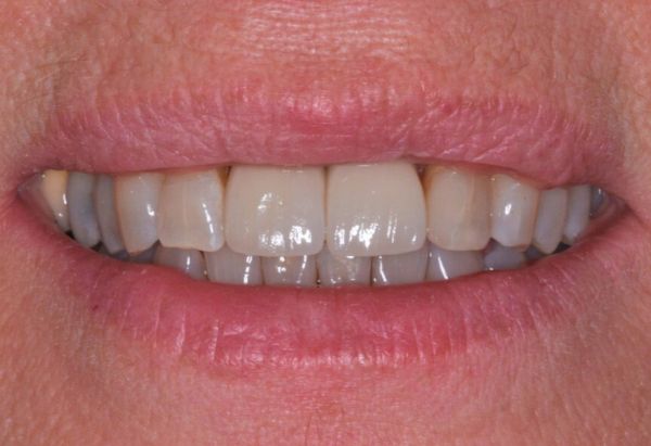 After -Peacock Dental Spa