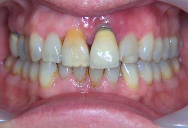 Before - Peacock Dental Spa