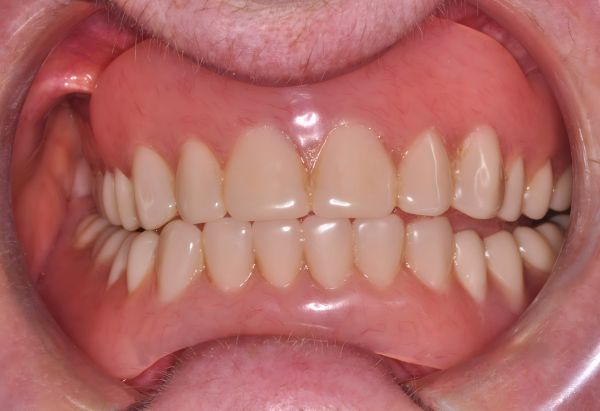 After -Peacock Dental Spa