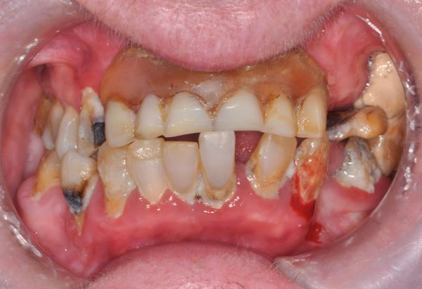 Before - Peacock Dental Spa