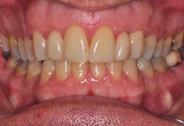 After -Peacock Dental Spa