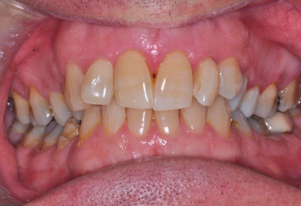 Before - Peacock Dental Spa