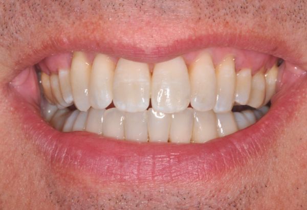 After -Peacock Dental Spa