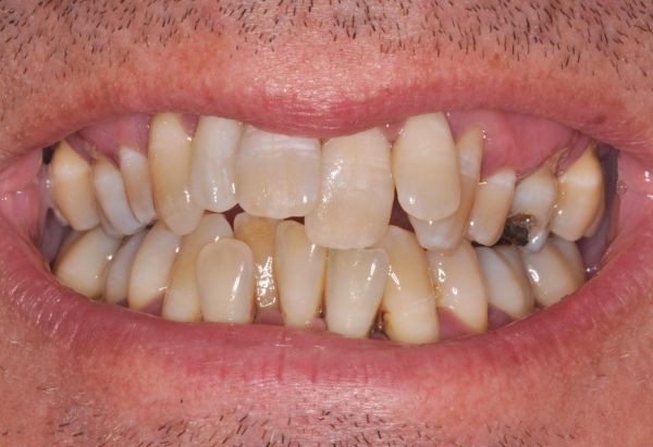 Before - Peacock Dental Spa