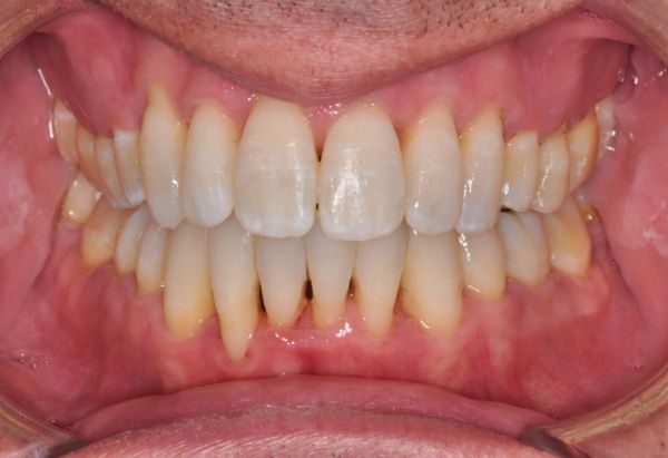 After -Peacock Dental Spa