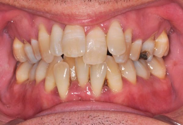 Before - Peacock Dental Spa