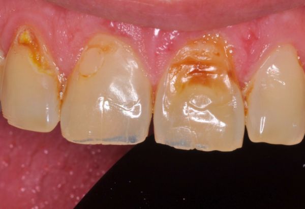 Before - Peacock Dental Spa