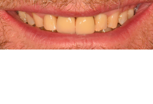 After - Peacock Dental Spa