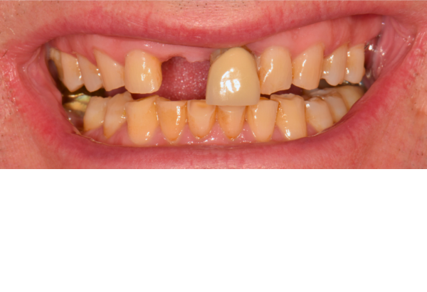 Before - Peacock Dental Spa