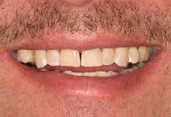 After - Peacock Dental Spa