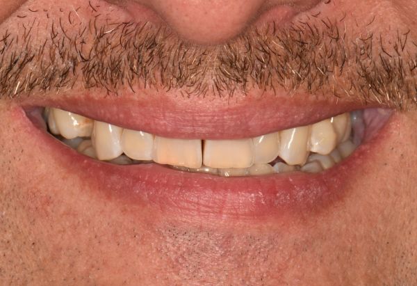 Before - Peacock Dental Spa