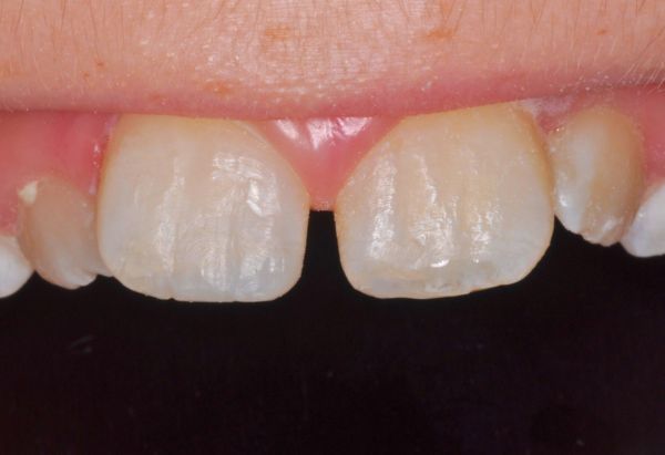 After - Peacock Dental Spa