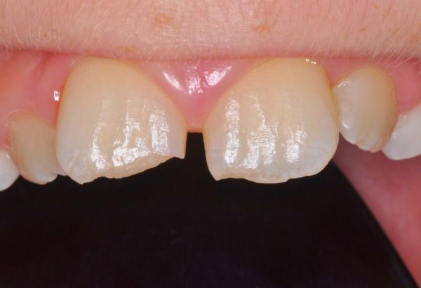 Before - Peacock Dental Spa