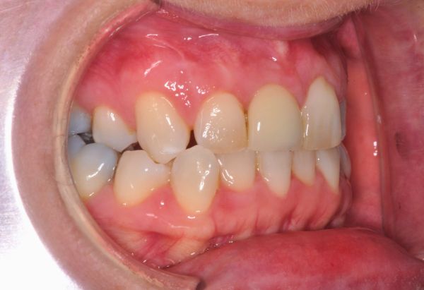 After - Peacock Dental Spa