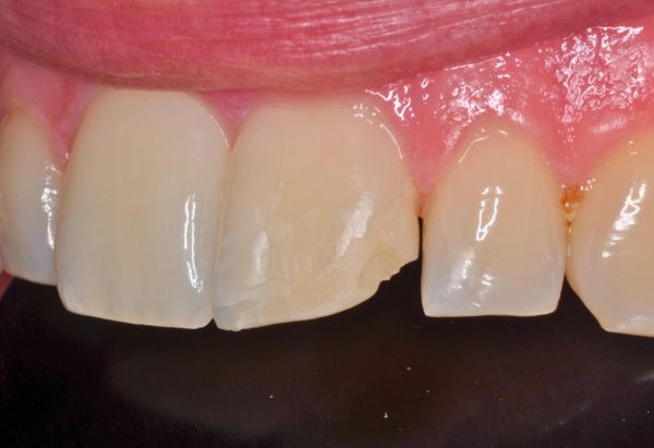 Before - Peacock Dental Spa