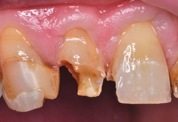 Before - Peacock Dental Spa