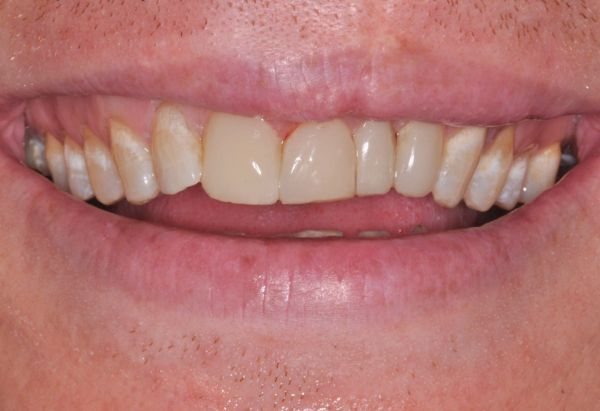 After - Peacock Dental Spa