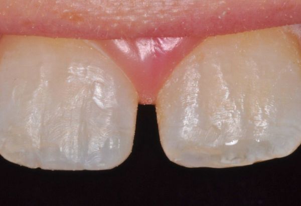 After -Peacock Dental Spa