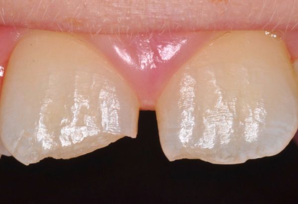 Before - Peacock Dental Spa