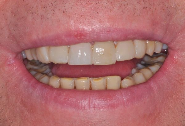 After -Peacock Dental Spa