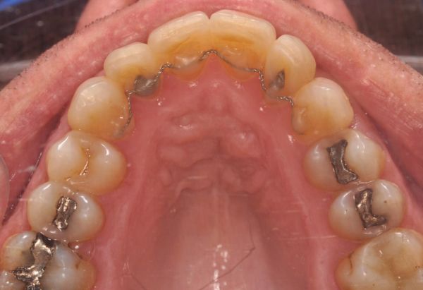 After -Peacock Dental Spa