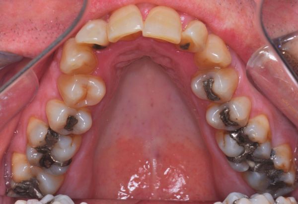 Before - Peacock Dental Spa