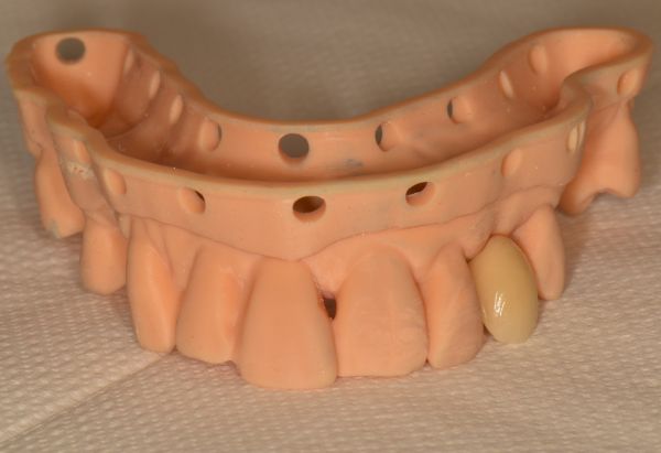 After -Peacock Dental Spa