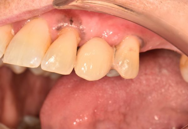 Before - Peacock Dental Spa