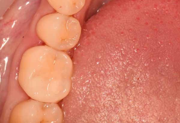 After -Peacock Dental Spa