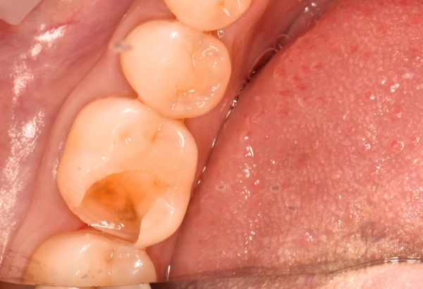 Before - Peacock Dental Spa