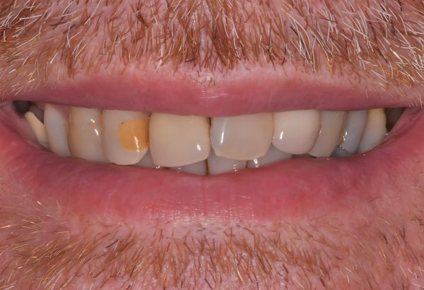 Before - Peacock Dental Spa