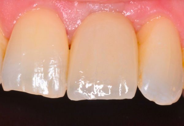 After -Peacock Dental Spa