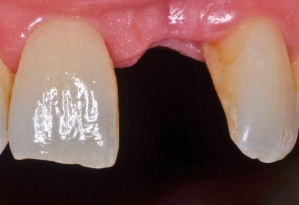 Before - Peacock Dental Spa