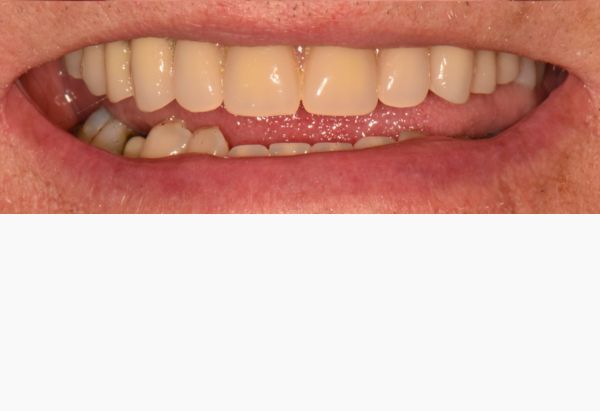 After -Peacock Dental Spa