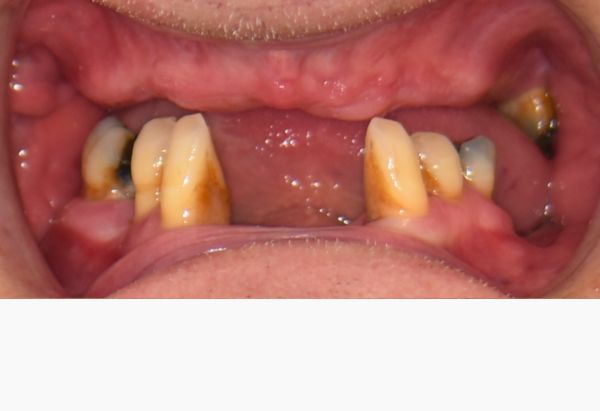 Before - Peacock Dental Spa