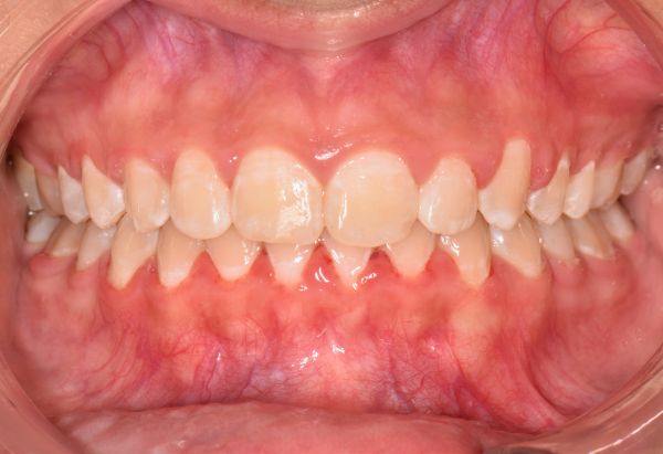 After -Peacock Dental Spa