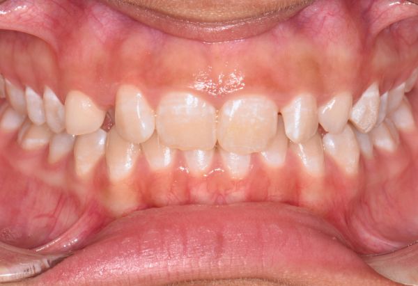 Before - Peacock Dental Spa