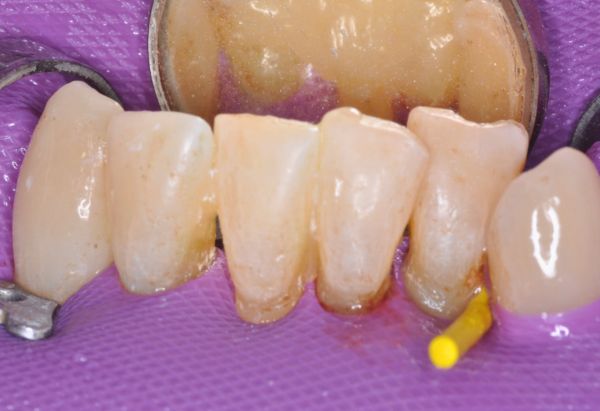 After -Peacock Dental Spa