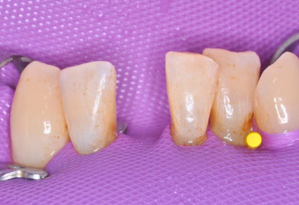 Before - Peacock Dental Spa