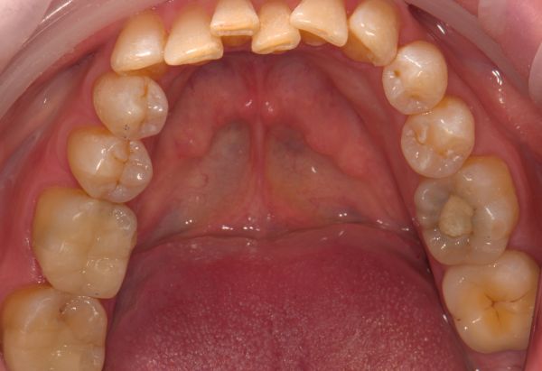 After -Peacock Dental Spa